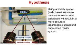 AR Ultrasound Hypothesis